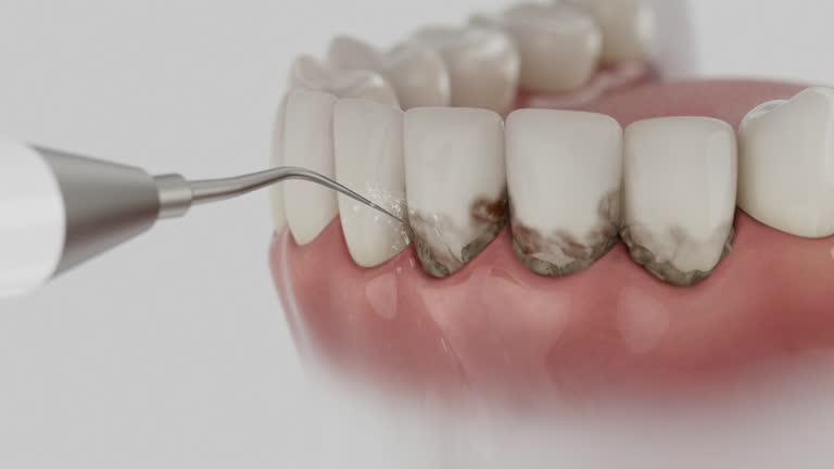 Trusted Emergency Dentist service in Cascade, ID - Dentist Open Now